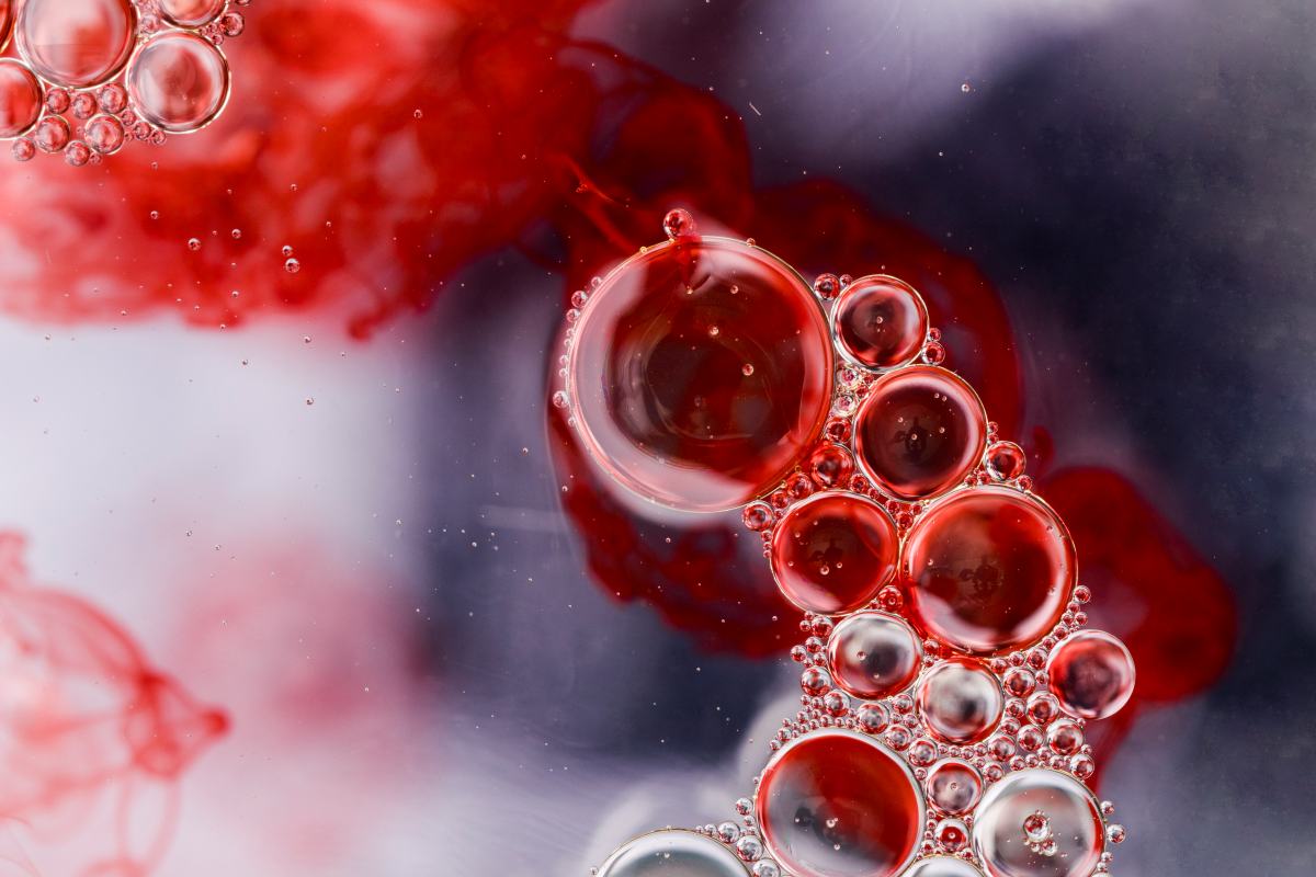 Aprende todo lo que necesitas saber sobre cómo combatir la anemia, qué alimentos son beneficiosos y cómo mejorar tu salud mediante tratamientos adecuados.