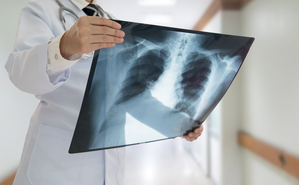 Conoce los diferentes tipos de prueba de tuberculosis, su realización y qué hacer en caso de un resultado positivo. Aprende todo lo que necesitas saber.