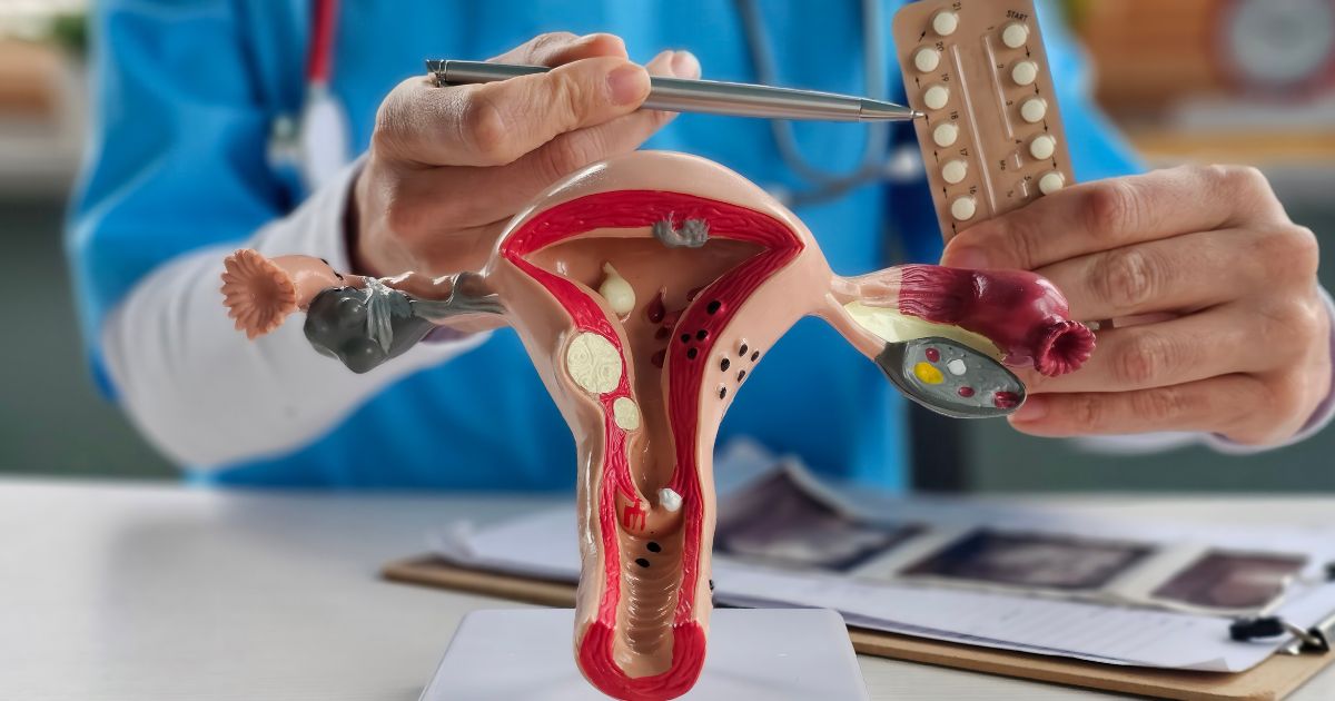 Analizamos las causas del sangrado fuera del ciclo: cambios hormonales, miomas o estrés. Conoce los signos de alarma y las diferencias con el spotting.